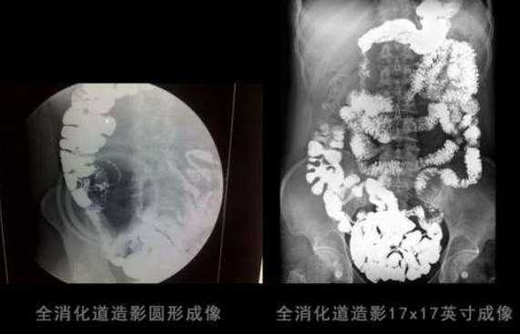 X-ray on human body